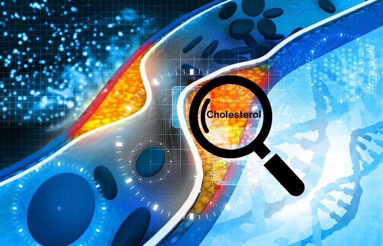 Dyslipidemia and elevated cholesterol levels - causes and possible solutions